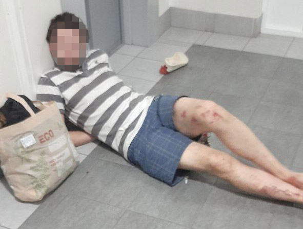 В парадной с «розочкой»